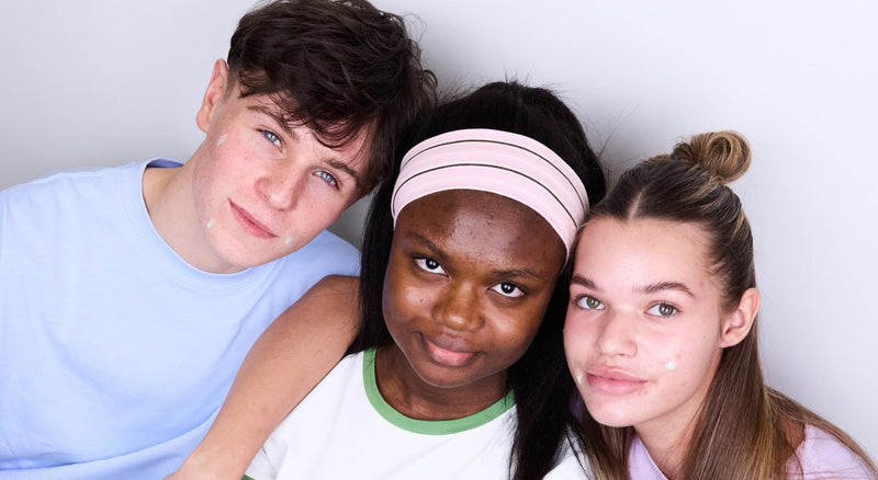 What’s the difference between day-to-day breakouts and severe acne?