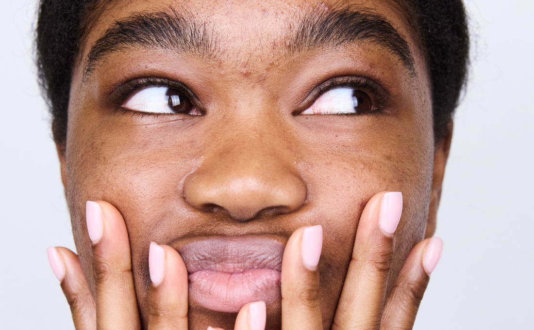 What does non-comedogenic mean?