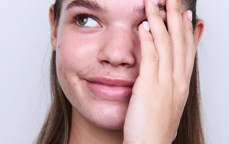 Spot myths: busted