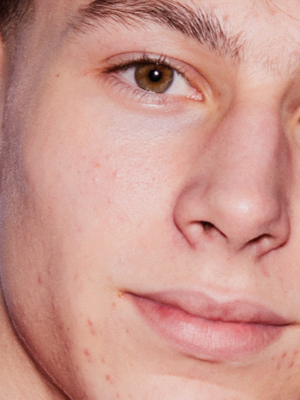 Skincare for Dry Skin