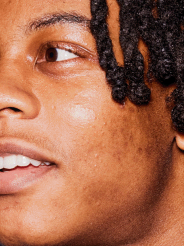 Skincare for Oily Skin